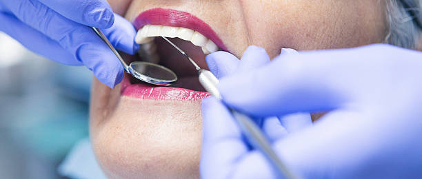 Best Dental Abscess Treatment in Strongsville, OH